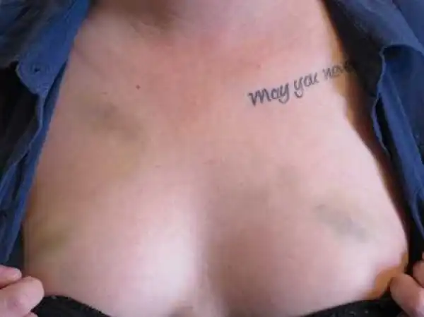 Group of Lesbians Brutally Beaten Up by 15 Homophobic Men Outside a Nightclub
